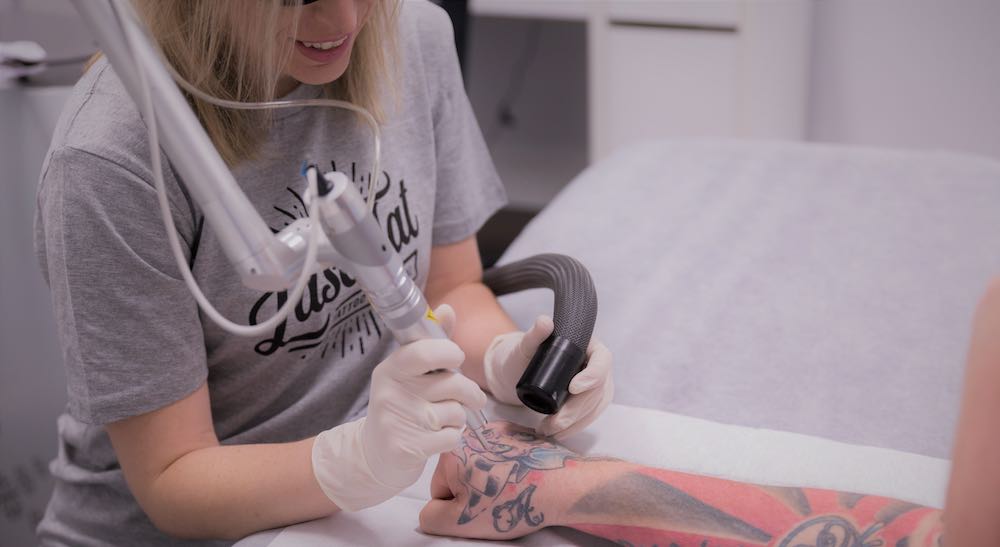 An Adelaide Company Is Combatting Unemployment With Australia's First Ever  Free Tattoo-Removal Service • Glam Adelaide