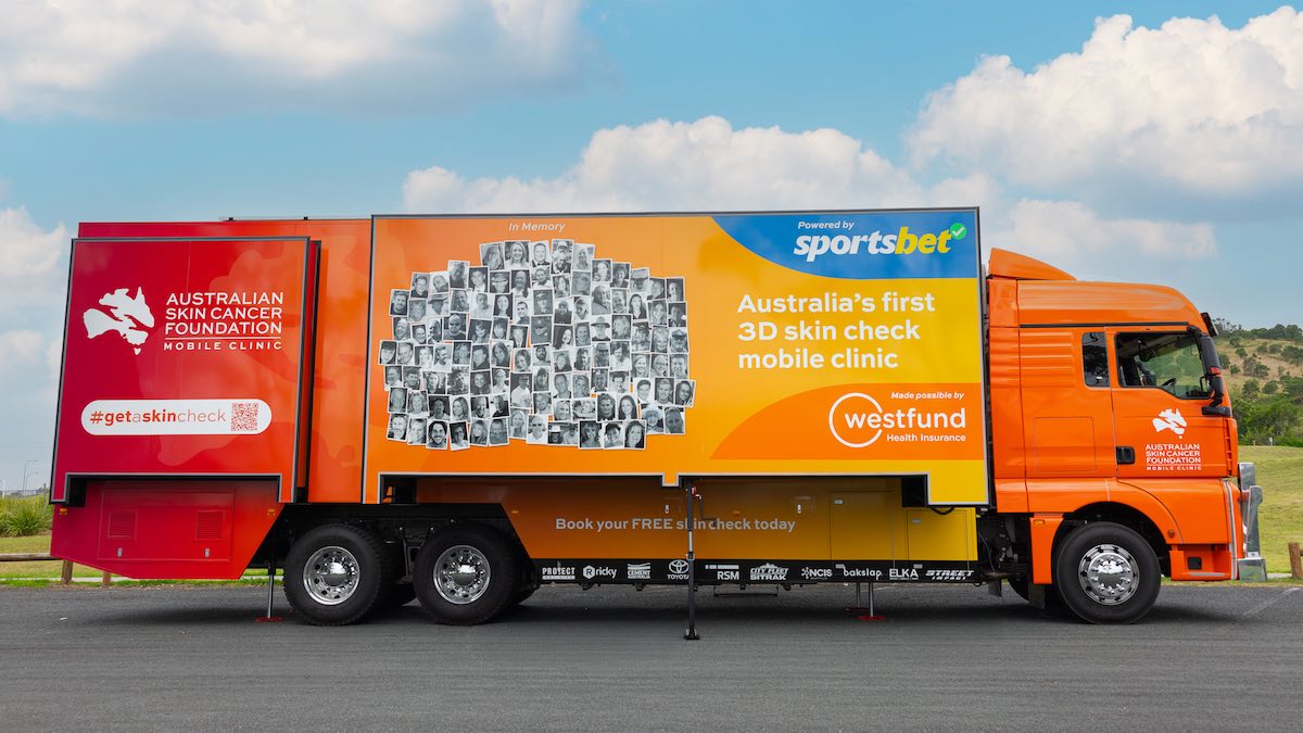 Free skin checks return to Gather Round with high-tech mobile clinic Free skin checks return to Gather Round with high-tech mobile clinic